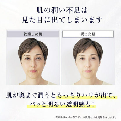 スキンベビー 薬用美白化粧水 150ml｜トラネキサム酸・グリチルリチン酸2K配合【医薬部外品】 - 公式 スキンベビー オンラインショップ