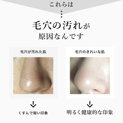 スキンベビー 濃密泡 洗顔フォーム ナチュラルクレイウオッシュ 100g 洗顔ネット付き｜ 天然クレイ×保湿成分でつるんと素肌へ - 公式 スキンベビー オンラインショップ