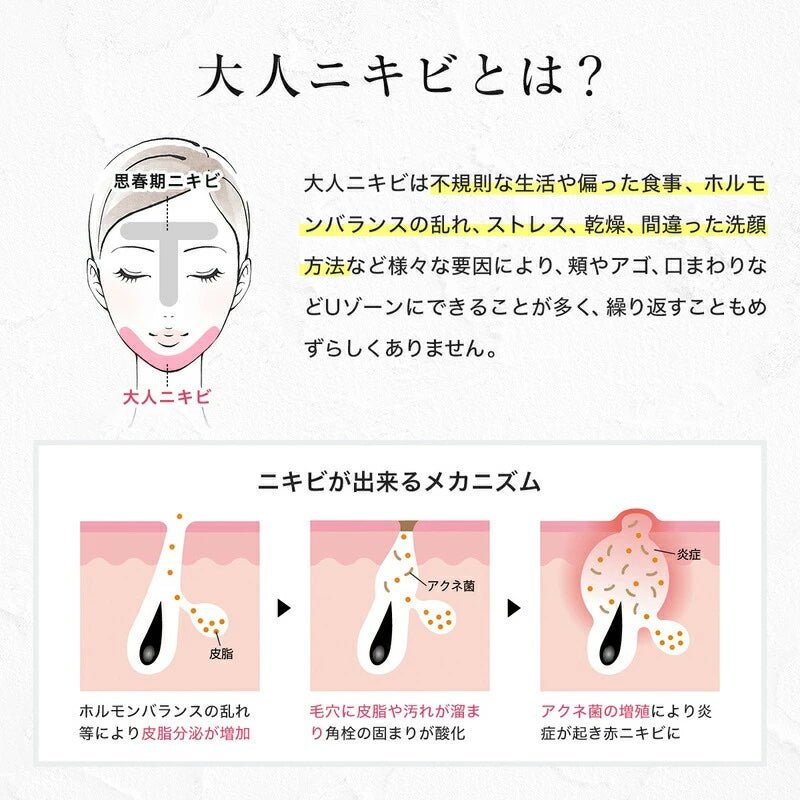 スキンベビー サリチル酸 濃密泡 クレイ 洗顔フォーム ホワイトクレウオッシュ 150g 医薬部外品 | 毛穴の汚れやニキビが気になる方へ。