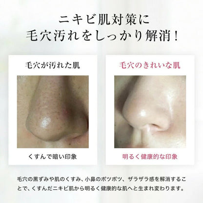 スキンベビー サリチル酸 濃密泡 クレイ 洗顔フォーム ホワイトクレウオッシュ 150g 医薬部外品 | 毛穴の汚れやニキビが気になる方へ。